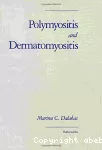 Polymyositis and dermatomyositis